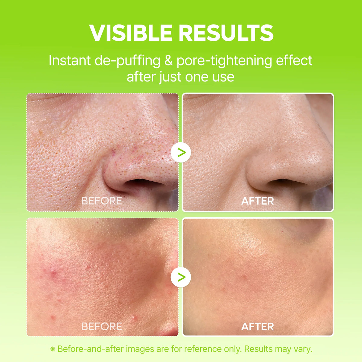 Summer Exclusive | 10-Step Skin Renewal Routine Set